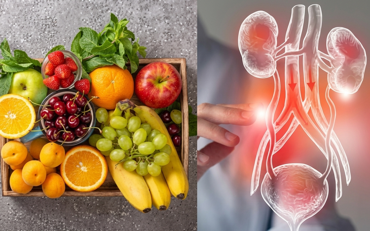 5 loại trái cây thải độc cơ thể tự nhiên và công thức nước detox dễ làm tại nhà - Ảnh 2.