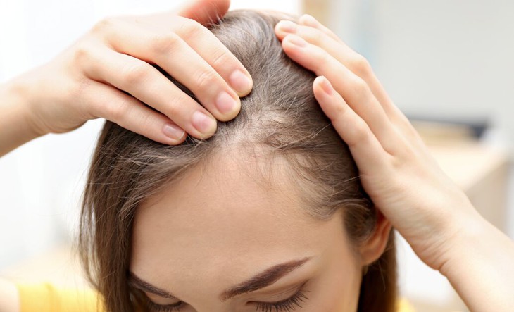 5 thói quen gây hại khiến tóc ngày càng mỏng đi- Ảnh 1.