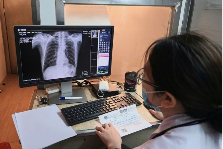 Bệnh viện Phổi Trung ương triển khai xe X-quang lưu động tại Ngày Sức khỏe toàn dân 7/4- Ảnh 1.