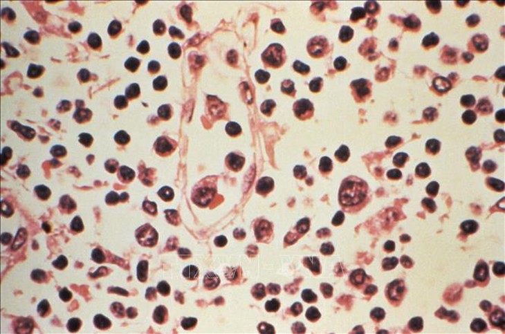 Tỷ lệ tử vong do nhiễm virus Hanta tăng cao, Chile nâng mức cảnh báo y tế- Ảnh 1.