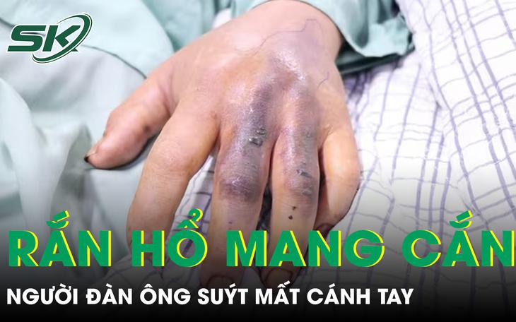 CSGT Hà Nội mở đường dưới mưa lớn đưa người đàn ông bị rắn hổ mang cắn đi cấp cứu- Ảnh 1.