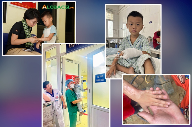 20 năm khoa Phẫu thuật tạo hình, Bệnh viện Xanh Pôn: Chữa lành khuyết hổng, rẽ hướng hàng vạn cuộc đời khiếm khuyết- Ảnh 4.