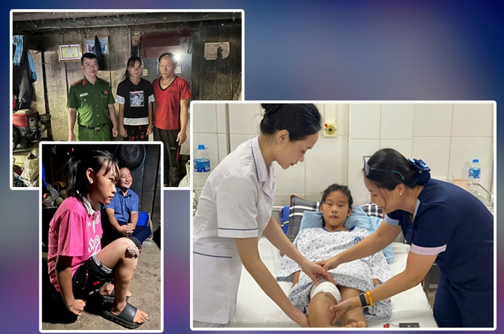 20 năm khoa Phẫu thuật tạo hình, Bệnh viện Xanh Pôn: Chữa lành khuyết hổng, rẽ hướng hàng vạn cuộc đời khiếm khuyết- Ảnh 6.