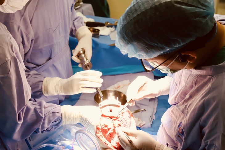 Bước tiến mới trong điều trị ung thư xương trẻ em: Thay khớp tăng trưởng nhân tạo cho bệnh nhi 6 tuổi- Ảnh 1.