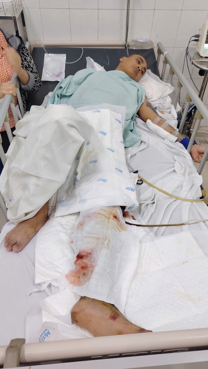Trên đường thăm hai con nhỏ, người cha trẻ gặp nạn nguy kịch, mẹ già bất lực trước chi phí điều trị- Ảnh 1.