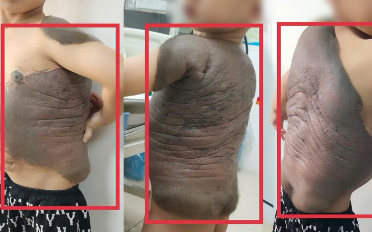 Vượt 1.300 km ra Hà Nội tìm cơ hội sống, bệnh nhân ung thư gan đón nhận phép màu - Ảnh 1.