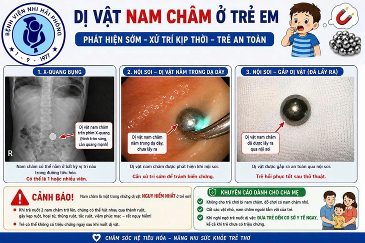 Bé gái 38 tháng tuổi nuốt phải nam châm và lời cảnh báo từ bác sĩ- Ảnh 1. Bé gái 38 tháng tuổi nuốt phải nam châm và lời cảnh báo từ bác sĩ- Ảnh 1.
