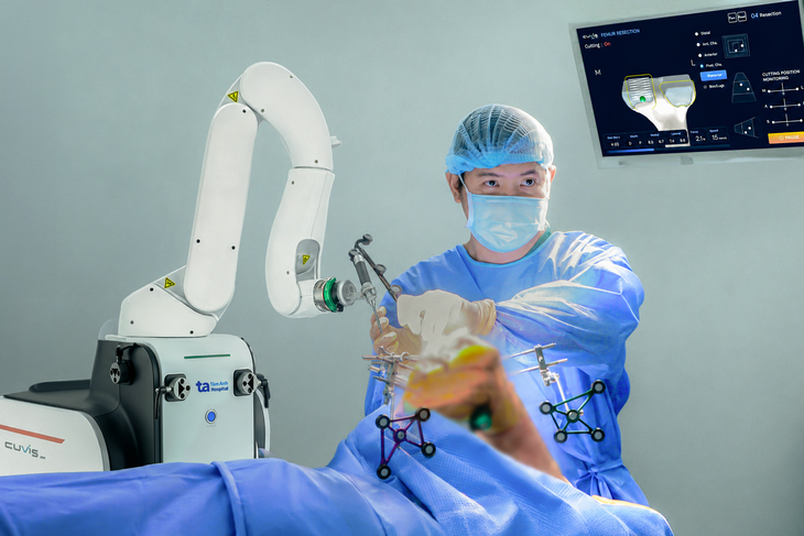 Bệnh viện Việt Nam đạt 3 chứng nhận quốc tế với robot AI thay khớp- Ảnh 3.