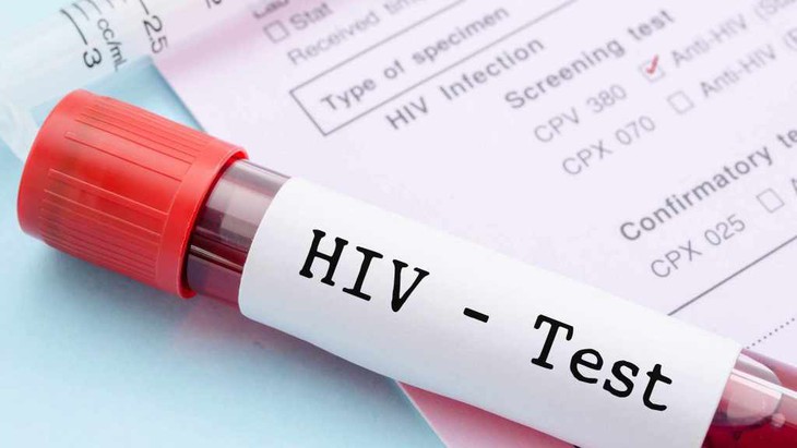 5 dấu hiệu cảnh báo nhiễm HIV nhiều người nhầm với bệnh thông thường - Ảnh 1.