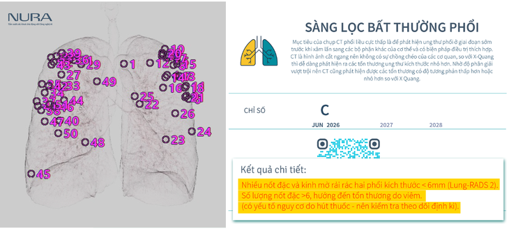 Chụp CT tầm soát ung thư: Nỗi lo tia bức xạ được giải quyết bằng AI - Ảnh 4.