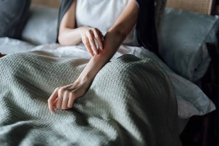 Ngứa da nhiều ban đêm, cảnh giác với suy thận - Ảnh 1.
