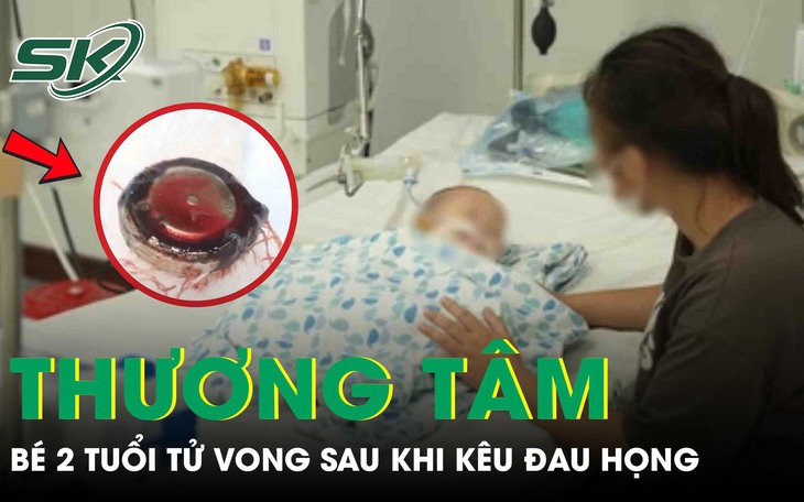 Ăn quá nóng, nam thanh niên bị tổn thương vùng họng- Ảnh 2.