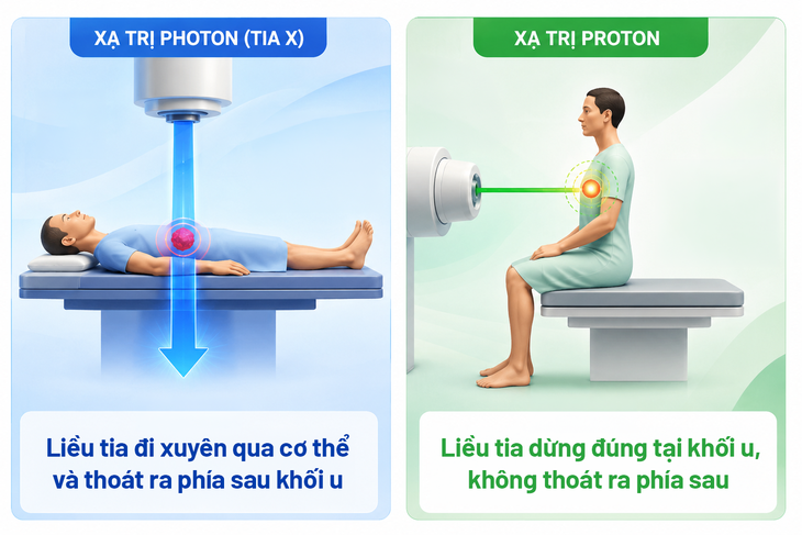 Vận hành hệ thống xạ trị proton tư thế ngồi đầu tiên thế giới, dự kiến về Việt Nam đầu 2027- Ảnh 2.