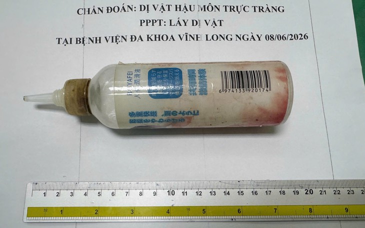Đi cấp cứu vì tiêu ra máu, phát hiện dị vật dài 3cm đâm thủng đại tràng - Ảnh 2.
