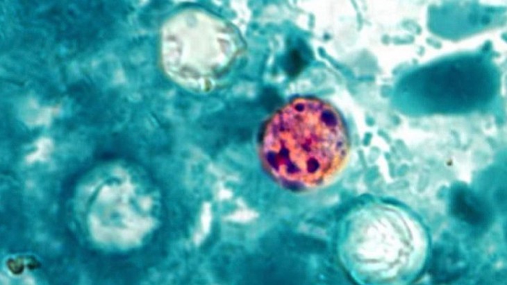 Bùng phát dịch bệnh tiêu hóa do ký sinh trùng Cyclospora ở 31 bang Mỹ 2026 - Ảnh 2.