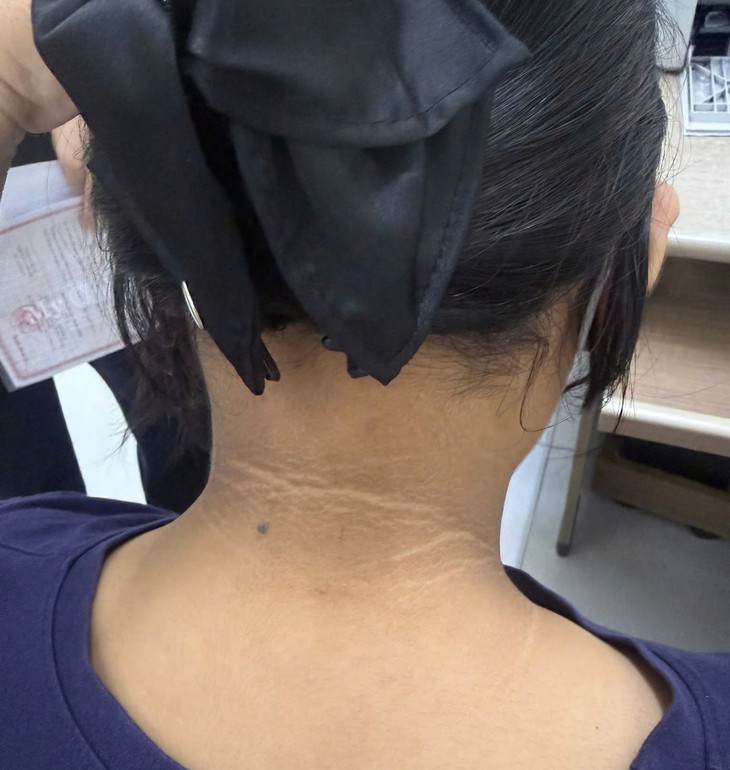Nhiều trẻ thừa cân, béo phì phát hiện đái tháo đường và rối loạn chuyển hóa ngay từ tuổi học đường - Ảnh 2.