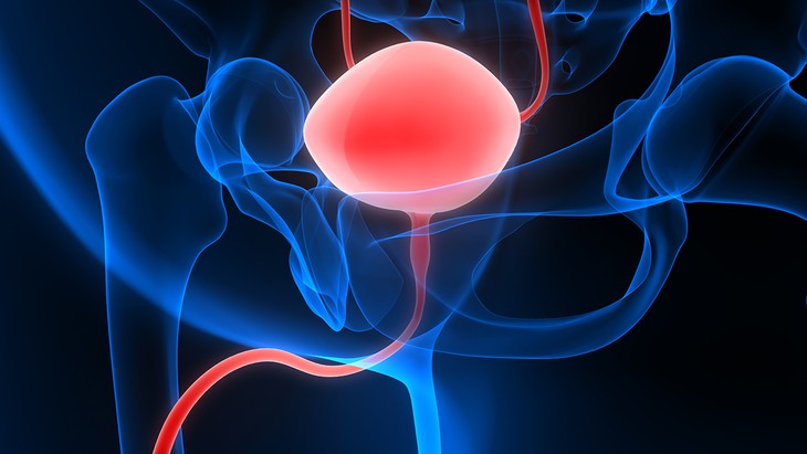 FDA bật đèn xanh cho phác đồ đột phá điều trị ung thư bàng quang mới- Ảnh 3.