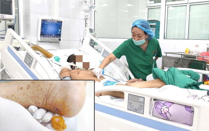 Hạ thân nhiệt xuống 33,5 độ C cứu trẻ ngạt nặng sau sinh- Ảnh 1.