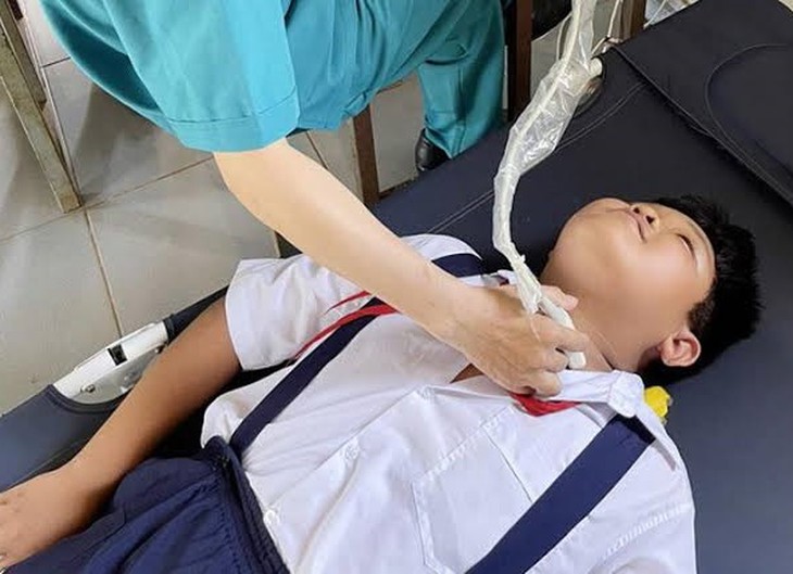 Trẻ em có mắc ung thư tuyến giáp không?- Ảnh 1.