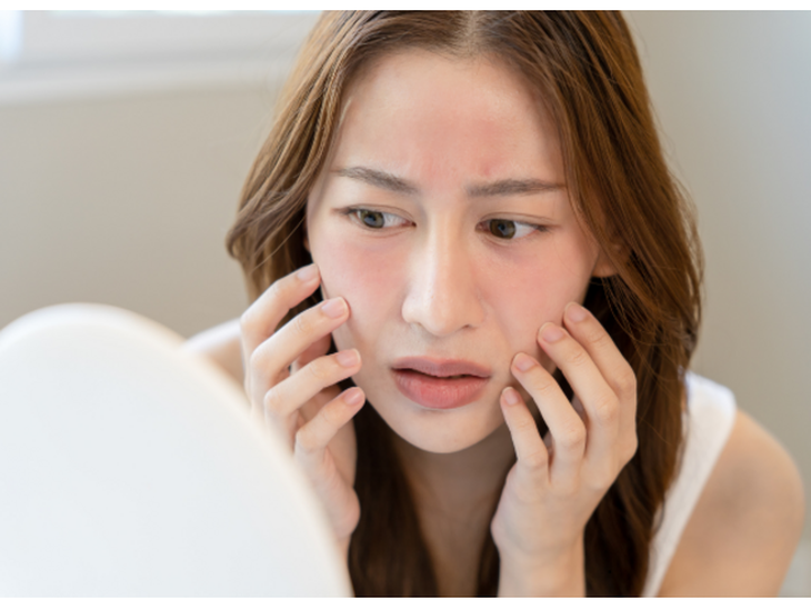Qua rồi những ngày nắng gắt, làn da đã thực sự được 'nghỉ'?- Ảnh 1.