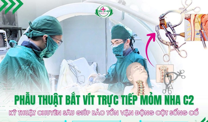 Bệnh viện HNĐK Nghệ An làm chủ kỹ thuật bắt vít trực tiếp mỏm nha C2, bảo tồn vận động cột sống cổ - Ảnh 2.