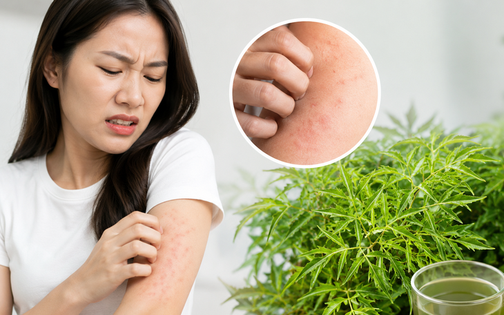 5 cách dùng lá đinh lăng cho người mất ngủ - Ảnh 2.