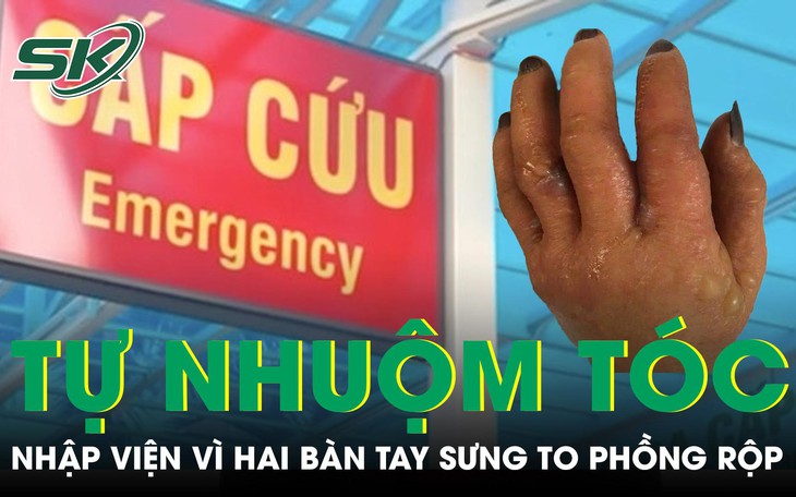 Chuyên gia giải đáp nhuộm tóc có gây ung thư không?- Ảnh 2.