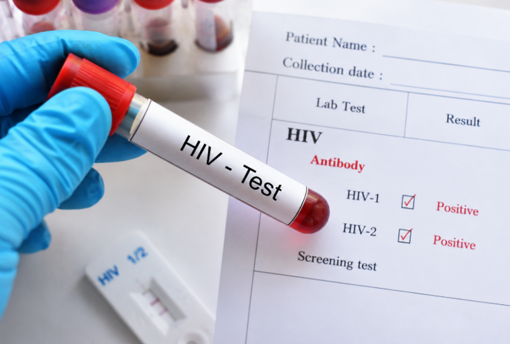 HIV có thể được phát hiện sớm như thế nào? Hiểu đúng ‘thời kỳ cửa sổ’ để không bỏ lỡ thời điểm xét nghiệm - Ảnh 1.