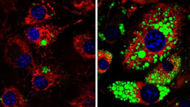 Lần đầu phát hiện loại protein có thể kích thích đốt mỡ nhưng không giảm cơ- Ảnh 1.