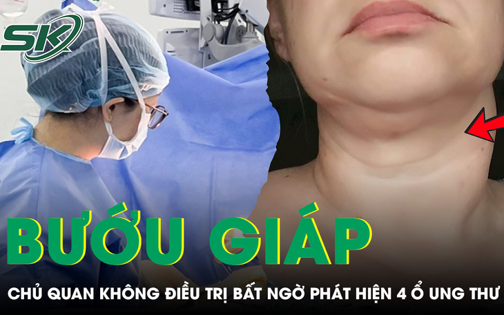10 năm không điều trị, bướu giáp phát triển khổng lồ chèn ép khí quản- Ảnh 3.