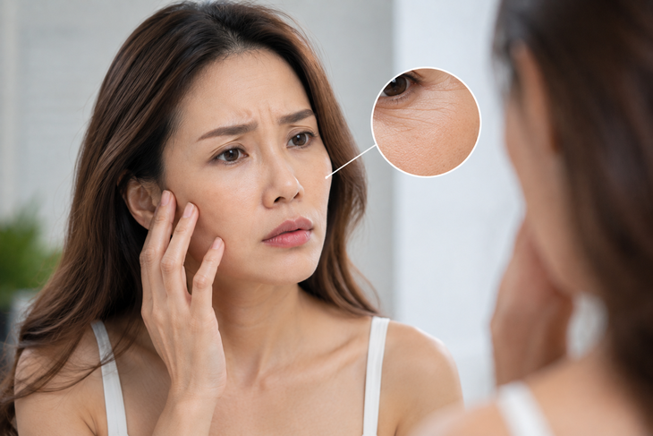 7 dấu hiệu làn da đang lão hóa nhanh hơn tuổi thật - Ảnh 1.