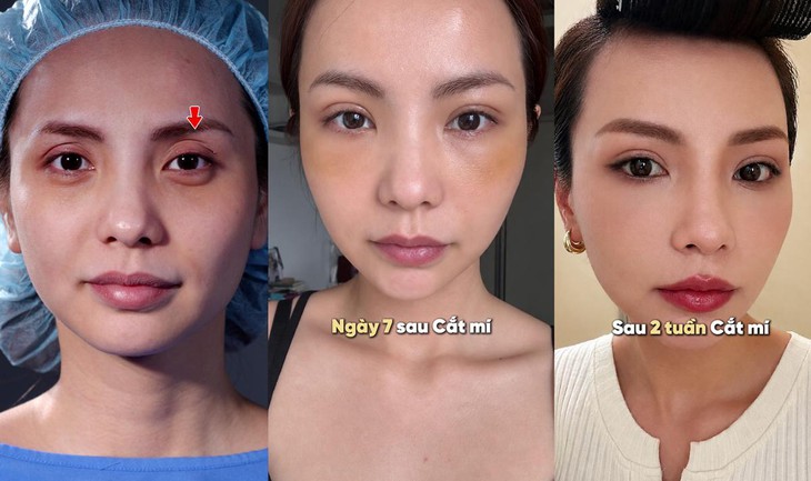 Diễn viên, MC Bùi Linh Chi trẻ hơn sau khi thay đổi một chi tiết trên gương mặt- Ảnh 3.