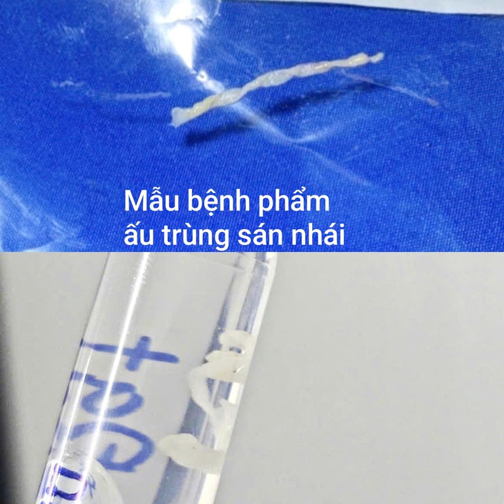 Suýt mang họa vì vô tình uống nước suối khi bơi- Ảnh 2.