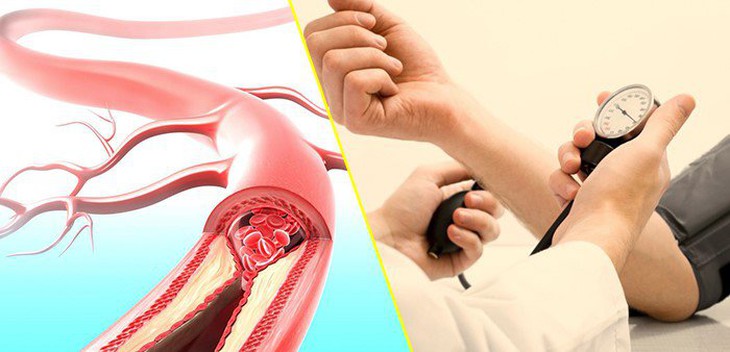 Có phải cứ chóng mặt là do cao huyết áp?- Ảnh 1.