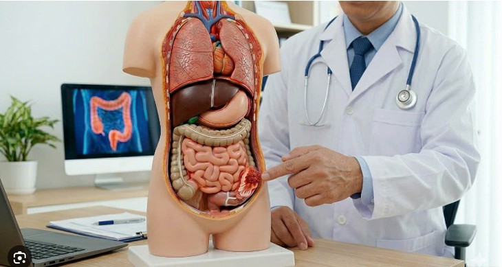 Ung thư đại tràng sống được bao lâu? Phát hiện sớm quyết định tiên lượng - Ảnh 2.