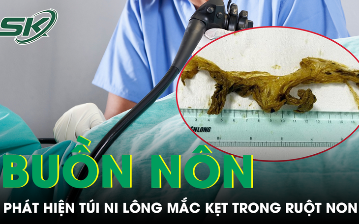 Hai ê-kíp phối hợp phẫu thuật ca chấn thương kép phức tạp- Ảnh 2.