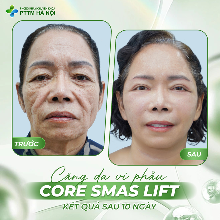 Phòng khám Chuyên khoa PTTM Hà Nội: Hành trình 'làm thật, giá trị thật' - Ảnh 2.