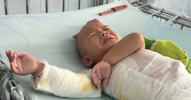 Mổ trong suốt 9 giờ, cứu khớp háng cho bé trai bị bệnh lý chất trắng- Ảnh 2.
