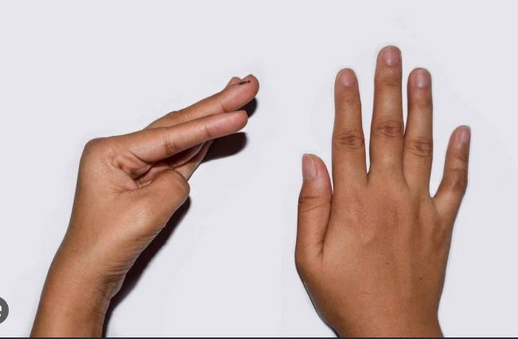 Làm sao phân biệt hạ kali và hạ canxi?- Ảnh 1.