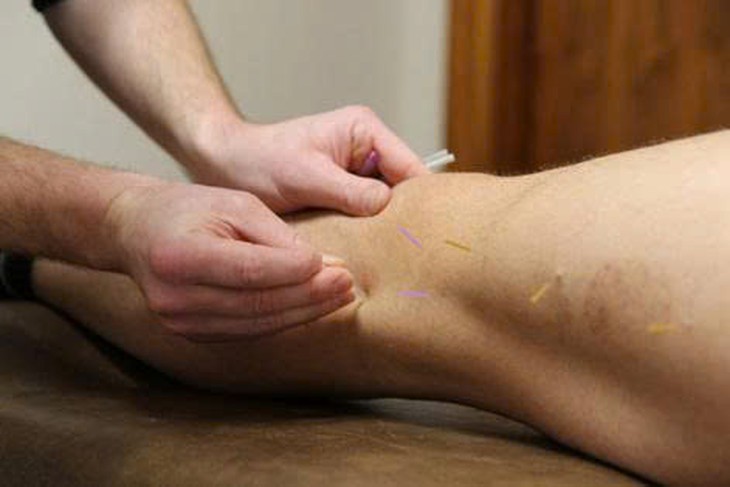 Ngồi lâu, ít vận động, bệnh suy giãn tĩnh mạch ngày càng phổ biến - Ảnh 1.