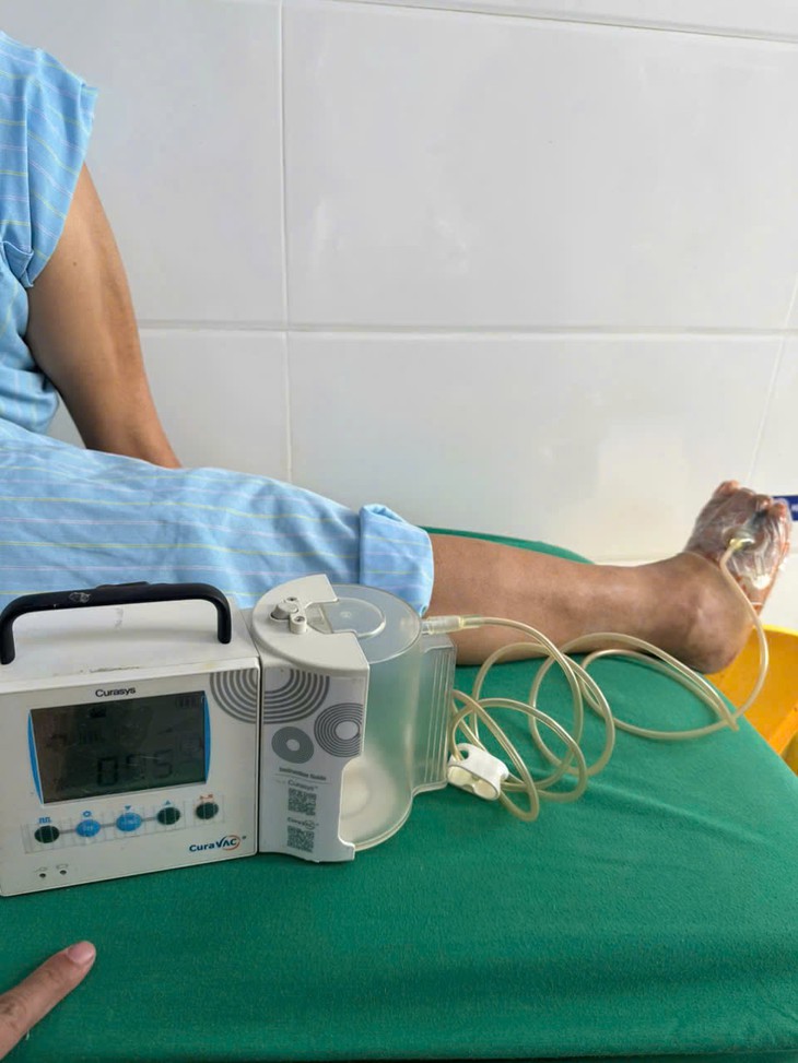Bảo tồn bàn chân cho người bệnh Lào bị nhiễm trùng do đái tháo đường - Ảnh 2.