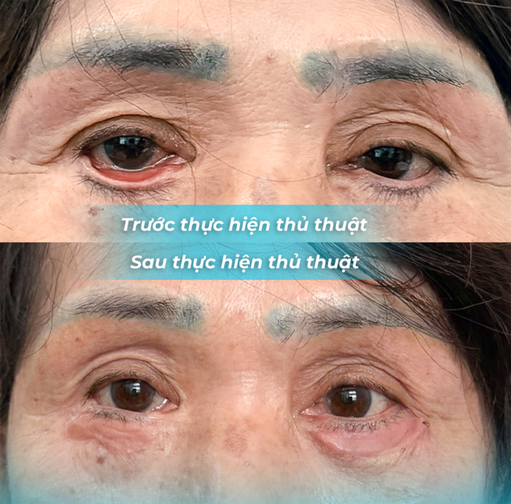 Phẫu thuật thẩm mỹ tại cơ sở làm đẹp, người phụ nữ tai biến nặng - Ảnh 2.