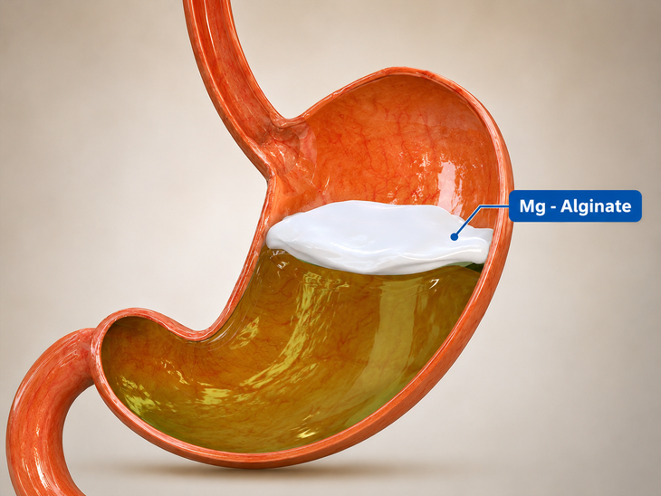 Giải pháp lớp gel 'bè nổi': Xu hướng trong kiểm soát trào ngược ở trẻ nhỏ- Ảnh 1.