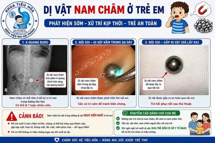 Bác sĩ khuyến cáo không cho trẻ chơi bi nam châm để tránh dị vật nguy hiểm - Ảnh 1.