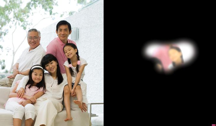 Chuyên gia Singapore cảnh báo nguy cơ mất thị lực không thể hồi phục do glaucoma- Ảnh 2.