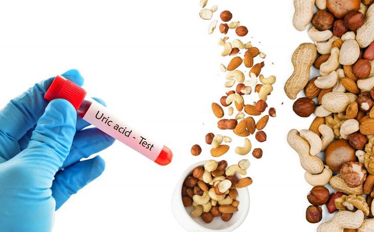 Tăng acid uric máu không chỉ do hải sản mà còn do nhiều thói quen - Ảnh 2.