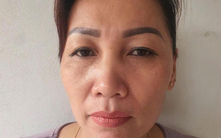 Cắt trộm cáp điện trung thế, 2 người bị điện phóng bỏng nặng- Ảnh 2.