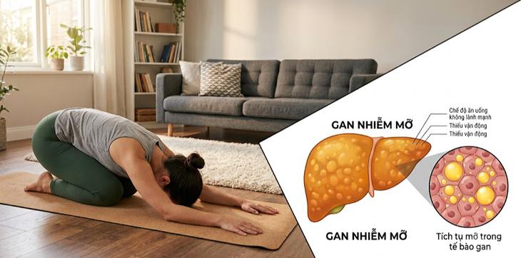 6 tư thế yoga giúp cải thiện sức khỏe gan - Ảnh 1.