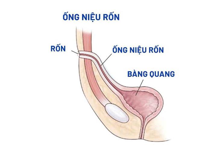  - Ảnh 3.