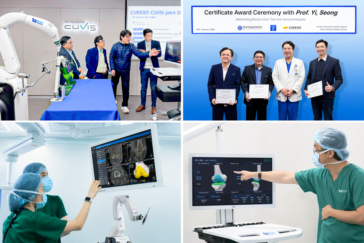 'Siêu robot thay khớp' Bệnh viện Tâm Anh vượt mốc 100 ca khó- Ảnh 3.